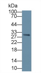 VTCN1 / B7-H4 Antibody - Western Blot; Sample: Human Serum; Primary Ab: 1µg/ml Rabbit Anti-Human VTCN1 Antibody Second Ab: 0.2µg/mL HRP-Linked Caprine Anti-Rabbit IgG Polyclonal Antibody