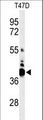 VTCN1 / B7-H4 Antibody - Western blot of VTCN1 Antibody in T47D cell line lysates (35 ug/lane). VTCN1 (arrow) was detected using the purified antibody.