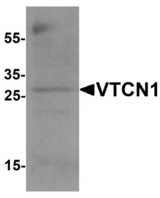VTCN1 / B7-H4 Antibody - Western blot analysis of VTCN1 in EL4 cell lysate with VTCN1 antibody at 1 ug/ml.