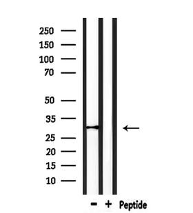 VTCN1 / B7-H4 Antibody - Western blot analysis of extracts of 293 cells using VTCN1 antibody. Lane 1 was treated with the antigen-specific peptide.