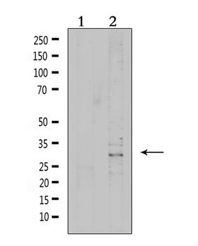 VTCN1 / B7-H4 Antibody