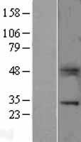 VTCN1 / B7-H4 Protein - Western validation with an anti-DDK antibody * L: Control HEK293 lysate R: Over-expression lysate