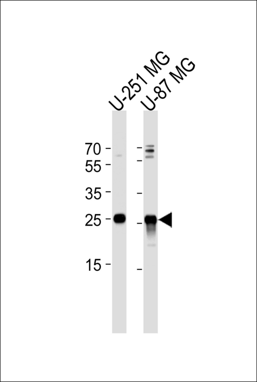VTI1A Antibody - Western blot of lysates from U-251 MG, U-87 MG cell line (from left to right), using VTI1A Antibody. Antibody was diluted at 1:1000 at each lane. A goat anti-rabbit IgG H&L (HRP) at 1:5000 dilution was used as the secondary antibody. Lysates at 35ug per lane.