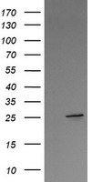VTI1A Antibody - HEK293T cells were transfected with the pCMV6-ENTRY control (Left lane) or pCMV6-ENTRY VTI1A (Right lane) cDNA for 48 hrs and lysed. Equivalent amounts of cell lysates (5 ug per lane) were separated by SDS-PAGE and immunoblotted with anti-VTI1A.