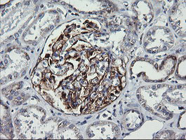 VTI1A Antibody - IHC of paraffin-embedded Human Kidney tissue using anti-VTI1A mouse monoclonal antibody. (Heat-induced epitope retrieval by 10mM citric buffer, pH6.0, 120°C for 3min).