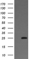 VTI1A Antibody - HEK293T cells were transfected with the pCMV6-ENTRY control (Left lane) or pCMV6-ENTRY VTI1A (Right lane) cDNA for 48 hrs and lysed. Equivalent amounts of cell lysates (5 ug per lane) were separated by SDS-PAGE and immunoblotted with anti-VTI1A.