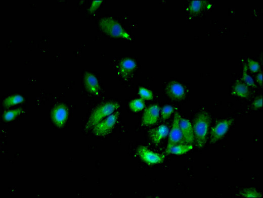 VTI1A Antibody - Immunofluorescent analysis of HepG2 cells using VTI1A Antibody at a dilution of 1:100 and Alexa Fluor 488-congugated AffiniPure Goat Anti-Rabbit IgG(H+L)
