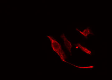 VTI1A Antibody - Staining NIH-3T3 cells by IF/ICC. The samples were fixed with PFA and permeabilized in 0.1% Triton X-100, then blocked in 10% serum for 45 min at 25°C. The primary antibody was diluted at 1:200 and incubated with the sample for 1 hour at 37°C. An Alexa Fluor 594 conjugated goat anti-rabbit IgG (H+L) antibody, diluted at 1/600, was used as secondary antibody.