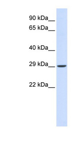 VTI1A Antibody - VTI1A antibody Western blot of Fetal Muscle lysate. This image was taken for the unconjugated form of this product. Other forms have not been tested.
