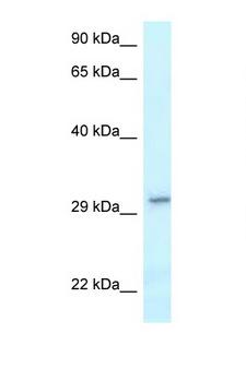 VTI1B Antibody - VTI1B antibody western blot of H226 Cell lysate. Antibody concentration 1 ug/ml.  This image was taken for the unconjugated form of this product. Other forms have not been tested.