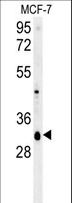 VTI1B Antibody - VTI1B Antibody western blot of MCF-7 cell line lysates (35 ug/lane). The VTI1B antibody detected the VTI1B protein (arrow).