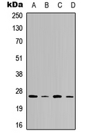 VTI1B Antibody - Western blot analysis of VTI1B expression in MCF7 (A); HeLa (B); rat heart (C); rat brain (D) whole cell lysates.