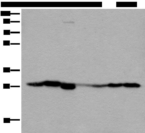 VTI1B Antibody - Western blot analysis of Human kidney tissue RAW264.7 cell Mouse kidney tissue Human lung tissue Human fetal liver tissue Hela and 231 cell lysates  using VTI1B Polyclonal Antibody at dilution of 1:300