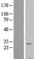 VTI1B Protein - Western validation with an anti-DDK antibody * L: Control HEK293 lysate R: Over-expression lysate
