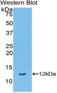 VTN / Vitronectin Antibody - Western blot of recombinant VTN / Vitronectin.  This image was taken for the unconjugated form of this product. Other forms have not been tested.