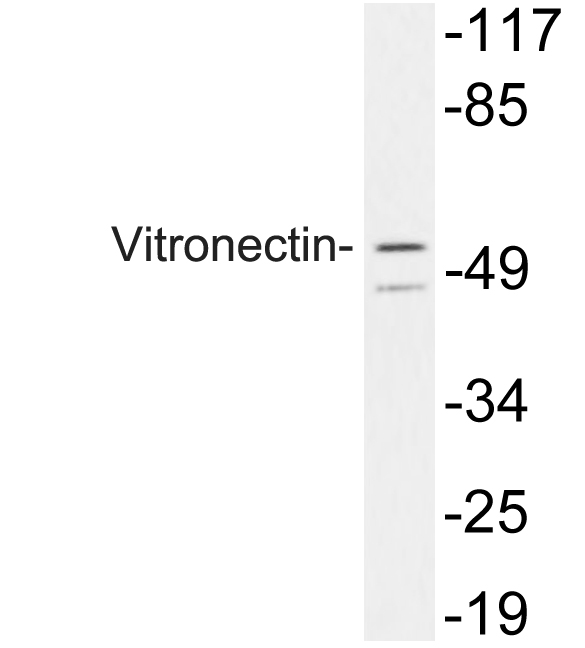 VTN / Vitronectin Antibody - Western blot analysis of lysate from 293 cells, using Vitronectin antibody.