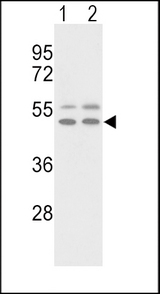 VTN / Vitronectin Antibody - Western blot of VTN Antibody in NCI-H460(lane 1), HepG2(lane 2) cell line lysates (35 ug/lane). VTN (arrow) was detected using the purified antibody.