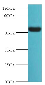 VTN / Vitronectin Antibody - Western blot. All lanes: Vitronectin antibody at 12 ug/ml+HepG2 whole cell lysate. Secondary antibody: Goat polyclonal to rabbit at 1:10000 dilution. Predicted band size: 54 kDa. Observed band size: 54 kDa Immunohistochemistry.