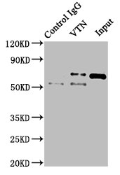 VTN / Vitronectin Antibody - Immunoprecipitating VTN in NIH/3T3 whole cell lysate Lane 1: Rabbit control IgG instead of VTN Antibody in NIH/3T3 whole cell lysate.For western blotting, a HRP-conjugated Protein G antibody was used as the secondary antibody (1/2000) Lane 2: VTN Antibody (8µg) + NIH/3T3 whole cell lysate (500µg) Lane 3: NIH/3T3 whole cell lysate (10µg)