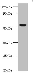 VTN / Vitronectin Antibody - Western blot All lanes: Vitronectin antibody at 12µg/ml + HepG2 whole cell lysate Secondary Goat polyclonal to rabbit IgG at 1/10000 dilution Predicted band size: 54 kDa Observed band size: 54 kDa