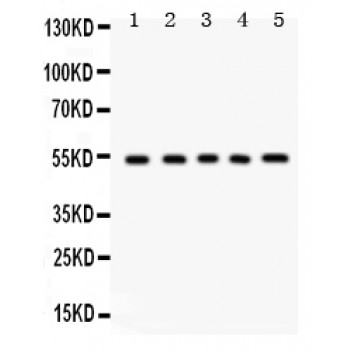 VTN / Vitronectin Antibody - Vitronectin antibody Western blot. All lanes: Anti Vitronectin at 0.5 ug/ml. Lane 1: Rat Liver Tissue Lysate at 50 ug. Lane 2: Rat Lung Tissue Lysate at 50 ug. Lane 3: HEPG2 Whole Cell Lysate at 40 ug. Lane 4: HELA Whole Cell Lysate at 40 ug. Lane 5: HEPA Whole Cell Lysate at 40 ug. Predicted band size: 54 kD. Observed band size: 54 kD.