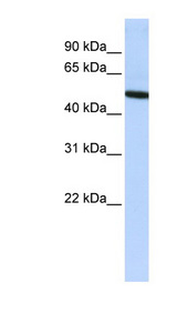 VTN / Vitronectin Antibody - VTN / Vitronectin antibody Western blot of HepG2 cell lysate. This image was taken for the unconjugated form of this product. Other forms have not been tested.