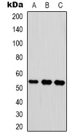 VTN / Vitronectin Antibody - Western blot analysis of Vitronectin expression in HEK293T (A); mouse brain (B); mouse lung (C) whole cell lysates.
