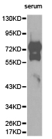 VTN / Vitronectin Antibody - Western blot of extracts of human serum tissue, using VTN antibody.