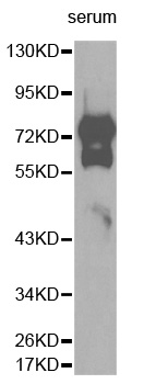 VTN / Vitronectin Antibody - Western blot analysis of extracts of human serum tissue.