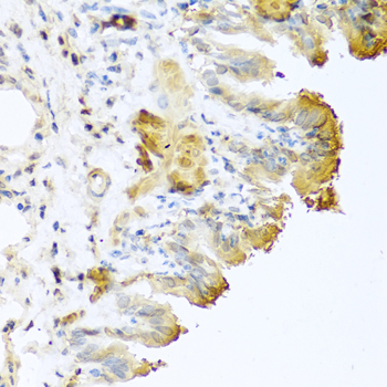 VTN / Vitronectin Antibody - Immunohistochemistry of formalin-fixed paraffin-embedded (FFPE) mouse lung using VTN antibody at dilution of 1:100 (40x magnification).
