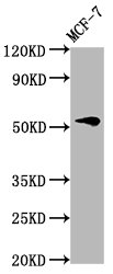 VTN / Vitronectin Antibody - Western Blot Positive WB detected in: MCF-7 whole cell lysate All Lanes: VTN antibody at 4.6µg/ml Secondary Goat polyclonal to rabbit IgG at 1/50000 dilution Predicted band size: 55 KDa Observed band size: 55 KDa