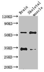 VTN / Vitronectin Antibody - Western Blot Positive WB detected in:Mouse brain tissue,Mouse skeletal muscle tissue All Lanes: VTN antibody at 2.8ug/ml Secondary Goat polyclonal to rabbit IgG at 1/50000 dilution Predicted band size: 55 kDa Observed band size: 55,34 kDa