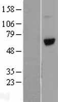 VTN / Vitronectin Protein - Western validation with an anti-DDK antibody * L: Control HEK293 lysate R: Over-expression lysate