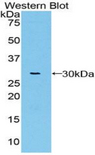 VWA1 / WARP Antibody - Western blot of recombinant VWA1 / WARP.  This image was taken for the unconjugated form of this product. Other forms have not been tested.