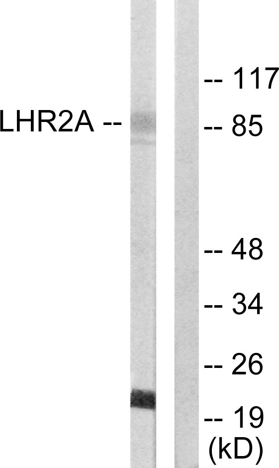 VWA5A Antibody - Western blot analysis of lysates from 293 cells, using LHR2A Antibody. The lane on the right is blocked with the synthesized peptide.