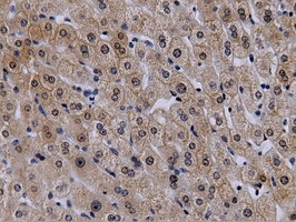 VWA5A Antibody - Immunohistochemical staining of paraffin-embedded Human liver tissue using anti-VWA5A mouse monoclonal antibody.