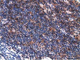 VWA5A Antibody - IHC of paraffin-embedded Human lymphoma tissue using anti-VWA5A mouse monoclonal antibody.