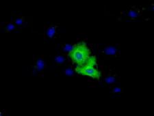 VWA5A Antibody - Anti-VMA5A mouse monoclonal antibody  immunofluorescent staining of COS7 cells transiently transfected by pCMV6-ENTRY VMA5A.