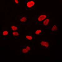 VWA5A Antibody - Immunofluorescent analysis of VWA5A staining in HeLa cells. Formalin-fixed cells were permeabilized with 0.1% Triton X-100 in TBS for 5-10 minutes and blocked with 3% BSA-PBS for 30 minutes at room temperature. Cells were probed with the primary antibody in 3% BSA-PBS and incubated overnight at 4 C in a humidified chamber. Cells were washed with PBST and incubated with a DyLight 594-conjugated secondary antibody (red) in PBS at room temperature in the dark. DAPI was used to stain the cell nuclei (blue).