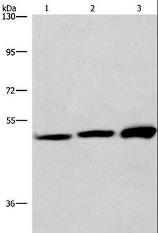 VWA5A Antibody - Western blot analysis of adrenal pheochromocytoma tissue,Jurkat and A549 cell, using VWA5A Polyclonal Antibody at dilution of 1:275.