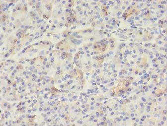 VWA5B2 Antibody - Immunohistochemistry of paraffin-embedded human pancreas tissue using antibody at 1:100 dilution.