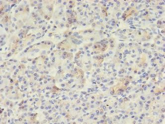 VWA5B2 Antibody - Immunohistochemistry of paraffin-embedded human pancreatic tissue using VWA5B2 Antibody at dilution of 1:100