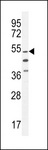 VWA9 / C15orf44 Antibody - CO044 Antibody western blot of HL-60 cell line lysates (35 ug/lane). The CO044 antibody detected the CO044 protein (arrow).