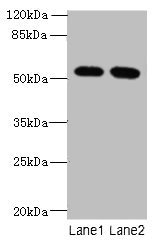 VWA9 / C15orf44 Antibody - Western blot All lanes: INTS14 antibody at 4µg/ml Lane 1: Hela whole cell lysate Lane 2: NIH/3T3 whole cell lysate Secondary Goat polyclonal to rabbit IgG at 1/10000 dilution Predicted band size: 58, 10, 49, 51 kDa Observed band size: 58 kDa