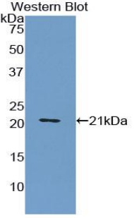 VWF / Von Willebrand Factor Antibody - Western blot of recombinant VWF / Von Willebrand Factor.  This image was taken for the unconjugated form of this product. Other forms have not been tested.