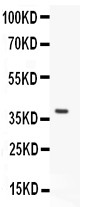 VWF / Von Willebrand Factor Antibody - VWF antibody Western blot. All lanes: Anti VWF at 0.5 ug/ml. WB: Recombinant Mouse VWF Protein 0.5ng. Predicted band size: 37 kD. Observed band size: 37 kD.