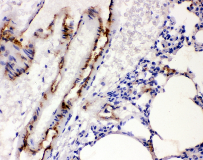 VWF / Von Willebrand Factor Antibody - IHC analysis of VWF using anti-VWF antibody. VWF was detected in paraffin-embedded section of rat lung tissues. Heat mediated antigen retrieval was performed in citrate buffer (pH6, epitope retrieval solution) for 20 mins. The tissue section was blocked with 10% goat serum. The tissue section was then incubated with 1µg/ml rabbit anti-VWF Antibody overnight at 4°C. Biotinylated goat anti-rabbit IgG was used as secondary antibody and incubated for 30 minutes at 37°C. The tissue section was developed using Strepavidin-Biotin-Complex (SABC) with DAB as the chromogen.