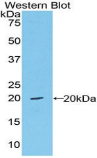 VWF / Von Willebrand Factor Antibody - Western blot of recombinant VWF / Von Willebrand Factor.  This image was taken for the unconjugated form of this product. Other forms have not been tested.