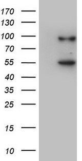 VWF / Von Willebrand Factor Antibody - SF9 cells lysate (5 ug, left lane) and SF9 cells lysate expressing human recombinant protein fragment (5 ug, right lane) corresponding to amino acids 764-1263 of human VWF (NP_000543) were separated by SDS-PAGE and immunoblotted with anti-VWF.