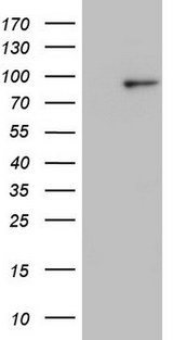 VWF / Von Willebrand Factor Antibody - SF9 cells lysate (5 ug, left lane) and SF9 cells lysate expressing human recombinant protein fragment (5 ug, right lane) corresponding to amino acids 764-1263 of human VWF (NP_000543) were separated by SDS-PAGE and immunoblotted with anti-VWF.